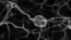 Nanobots - Nerve Cells Black & White Image